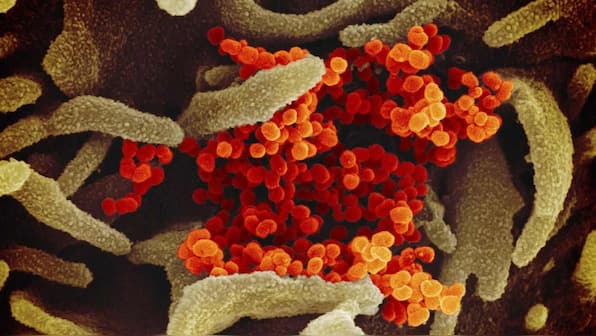 Coronavirus not man-made but a product of natural evolution, suggests a new study