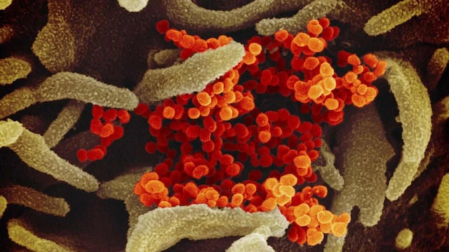 Coronavirus not man-made but a product of natural evolution, suggests a new study Coronavirus not man-made but a product of natural evolution, suggests a new study