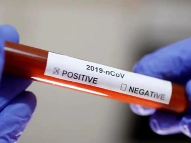 Coronavirus Global Roundup, May 6: Cases surge in Germany, UK death toll crosses Italy's, study finds new virus strain Coronavirus Global Roundup, May 6: Cases surge in Germany, UK death toll crosses Italy's, study finds new virus strain