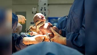 Assisted Reproductive Technology Regulation Bill addresses regulation lacunae in fertility industry, but its non-inclusiveness is troubling