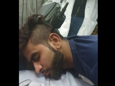 Delhi violence: Miracle at GTB hospital as 19-year-old survives after miscreants push drill into his head Delhi violence: Miracle at GTB hospital as 19-year-old survives after miscreants push drill into his head