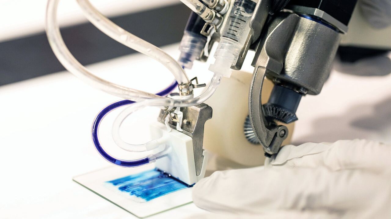 Handheld 3D printer can print skin cells on burn injuries too serious for skin graftin Handheld 3D printer can print skin cells on burn injuries too serious for skin graftin