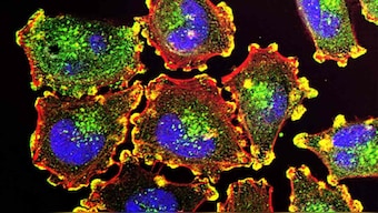 World Cancer Day 2020: Delving into the genetics of cancer offers experts clarity, insights aplenty