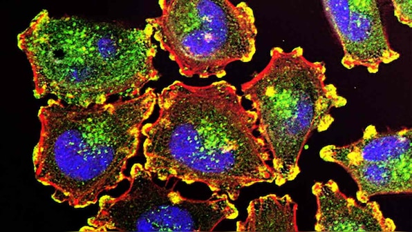 World Cancer Day 2020: Delving into the genetics of cancer offers experts clarity, insights aplenty