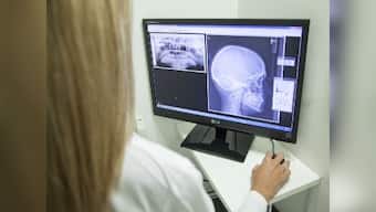 3D printing in surgery: AIIMS introduces new jaw joint replacement