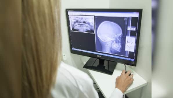 3D printing in surgery: AIIMS introduces new jaw joint replacement