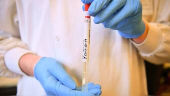 FDA flags inaccuracies in widely-used genetic COVID-19 test that returned false positive results