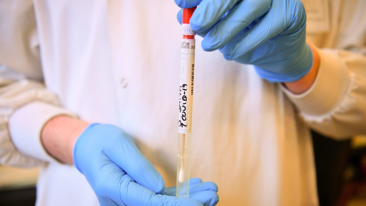 FDA flags inaccuracies in widely-used genetic COVID-19 test that returned false positive results FDA flags inaccuracies in widely-used genetic COVID-19 test that returned false positive results