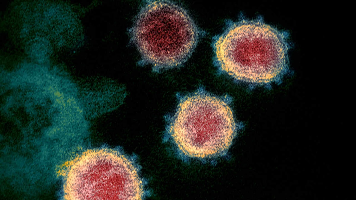 Does coronavirus spread via surfaces, sneezes or sex? A look at how COVID-19 can and cannot be contracted