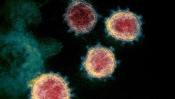 Does coronavirus spread via surfaces, sneezes or sex? A look at how COVID-19 can and cannot be contracted