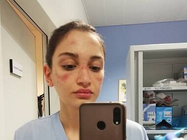 International Nurses Day 2020: 'Nursing the world to health', here’s all you need to know