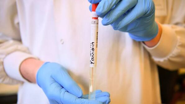 Coronavirus Outbreak: How COVID-19 testing kits work and new testing tech currently in development