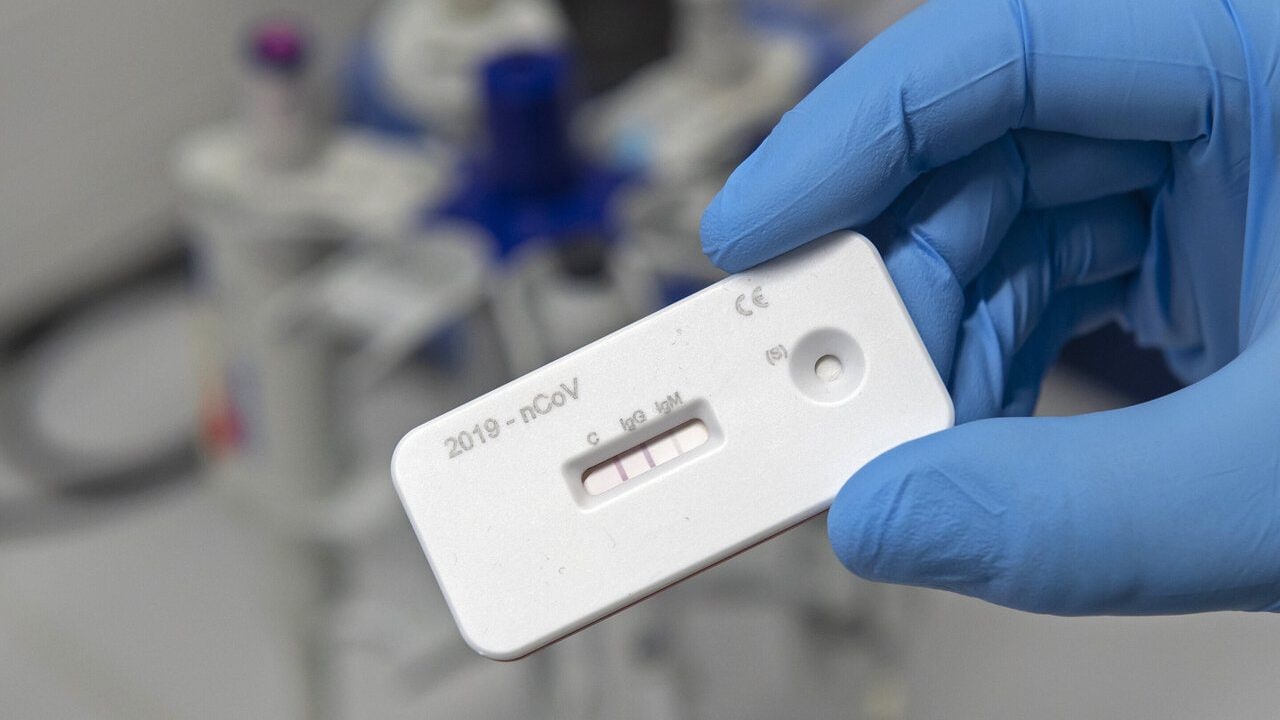 a scientist presents an antibody test to use with a blood sample for the coronavirus at a laboratory. Image credit: AP