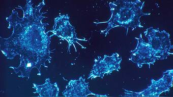 Cancer patients infected with Coronavirus are three times more likely to die: Study