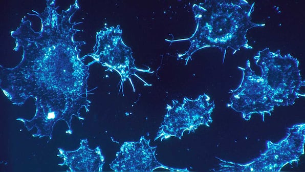 Cancer patients infected with Coronavirus are three times more likely to die: Study