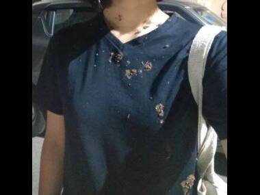 Unpacking 'chinki': Unlike 'dkhar', a term used for non-tribals, the slur is rooted in racial derision, power dynamics