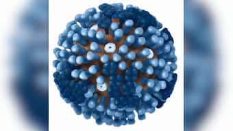 Overactivation of immune cells in severe COVID-19 cases resembles lupus, may indicate need for follow-up care