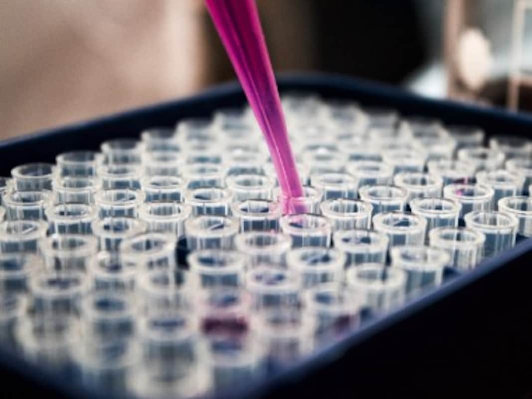 China Finds 300 Asymptomatic Cases After Testing 9 89 Mn In Wuhan