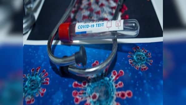Does having COVID-19 antibodies mean that you are immune to the disease?