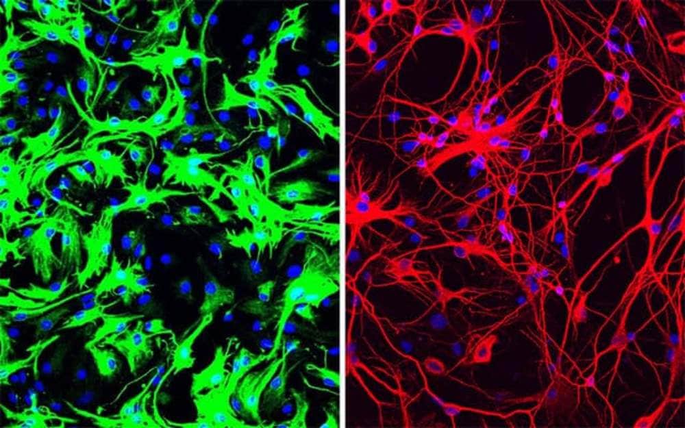 Left: mouse astrocytes (green) before reprogramming; Right: neurons (red) induced from mouse astrocytes after reprogramming with PTB antisense oligonucleotide treatment. Image credit: University of California 