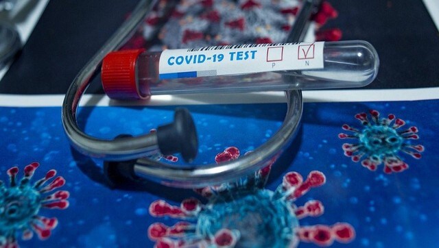Second wave of COVID-19: What we can learn from 1918 Spanish flu and why caution fatigue is biggest challenge Second wave of COVID-19: What we can learn from 1918 Spanish flu and why caution fatigue is biggest challenge