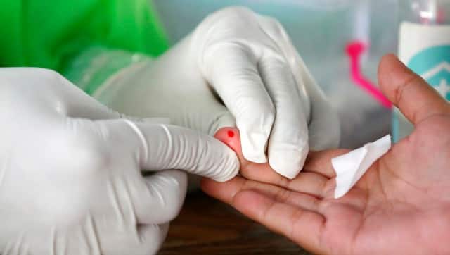 Representational image. AP