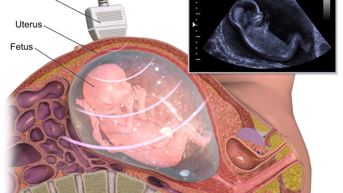 Scientists create embryo-like research model to help them study the earliest stages of human development