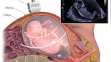 Scientists create embryo-like research model to help them study the earliest stages of human development