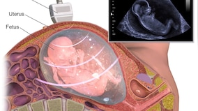 Scientists create embryo-like research model to help them study the earliest stages of human development