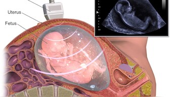 Scientists create embryo-like research model to help them study the earliest stages of human development