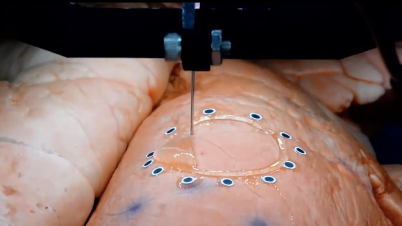 The new technique developed by University of Minnesota researchers allows 3D printing of hydrogel-based sensors directly on organs, like the lungs, that change shape or distort due to expanding and contracting. Image: Screengrab from McAlpine Research Group, University of Minnesota/YouTube