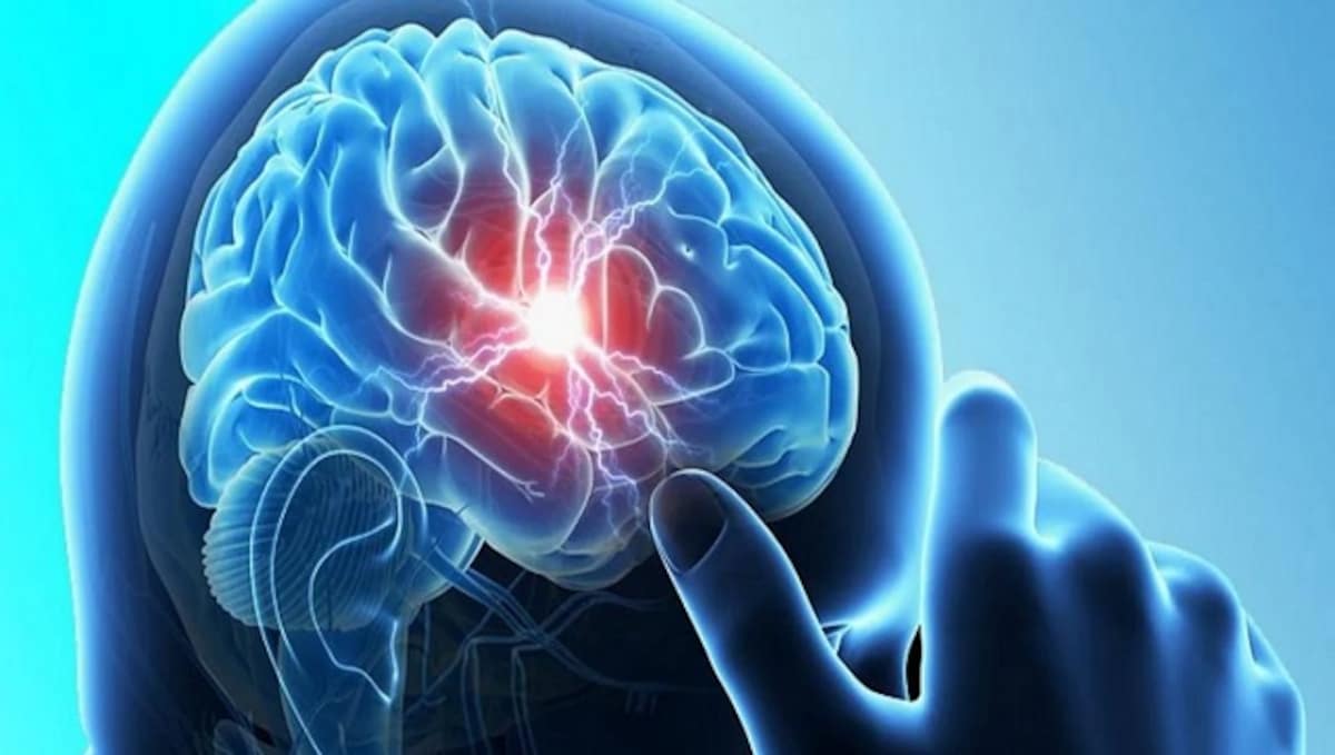World Brain Tumour Day 2020: All you need to know about brain tumours,  their symptoms and treatments-Health News , Firstpost