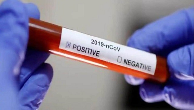 Coronavirus Outbreak: Kerala to conduct antibody tests on large scale from 8 June to check community spread; confirmed cases at 1,699 Coronavirus Outbreak: Kerala to conduct antibody tests on large scale from 8 June to check community spread; confirmed cases at 1,699