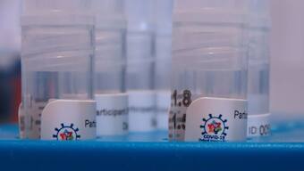 Oxford's vaccine offers ‘good duration of immunity’ to COVID-19 compared to no vaccine: lead researcher