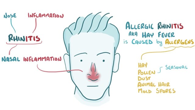 Allergic Rhinitis: A neglected disease sharing symptoms with COVID-19 ...
