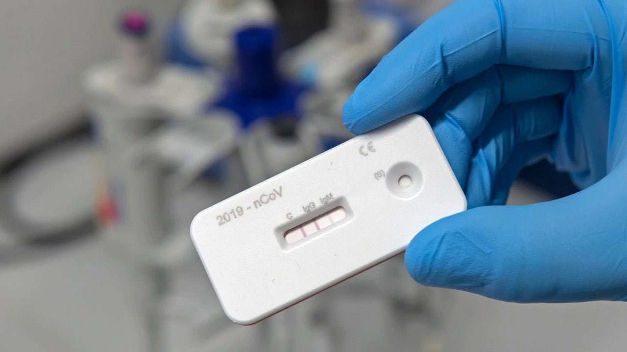 An antibody testing kit for COVID-19. Image: CCPP19