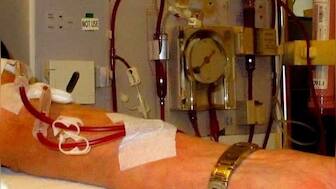 Why dialysis patients and their families are at higher risk of mental health issues