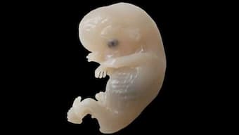 COVID-19 infection less prevalent among newborns, lack of ACE-2 receptors in placenta may shield fetus, claims NIH study