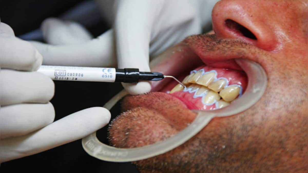Poor oral hygiene in COVID19 patients can increase their risk of lung