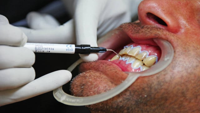 Poor oral hygiene in COVID-19 patients can increase their risk of lung infections and pneumonia, says UK study Poor oral hygiene in COVID-19 patients can increase their risk of lung infections and pneumonia, says UK study