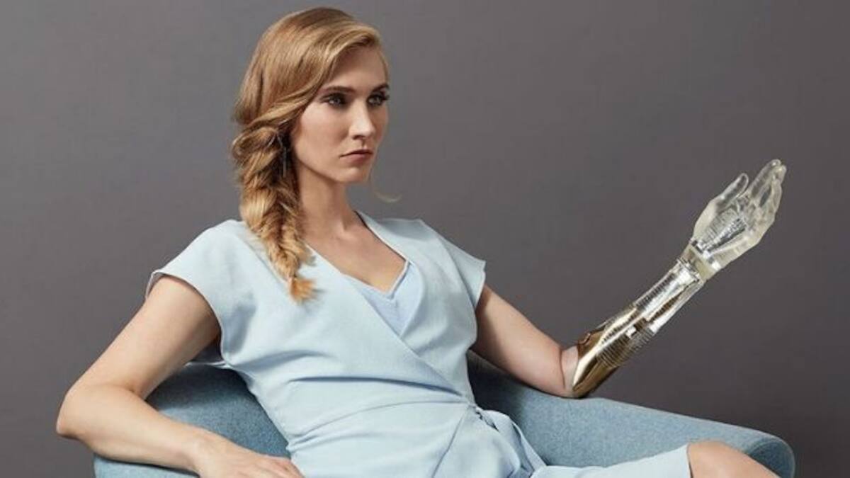 Can expressive prosthetic limbs change our perceptions towards ...