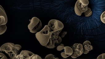 Bacteria that eats metal, processes carbon accidentally discovered on dirty lab equipment
