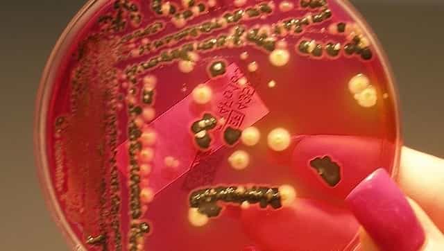 How salmonella can enter human body through vegetables: Tips to stop bacteria from causing food poisoning How salmonella can enter human body through vegetables: Tips to stop bacteria from causing food poisoning