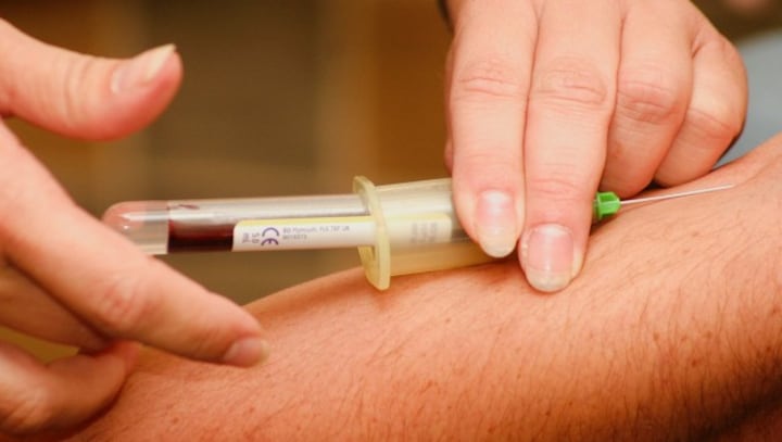 Abnormal blood clotting in COVID-19 patients: Researchers at Yale Cancer Centre explain why it occurs and how it could be detected early