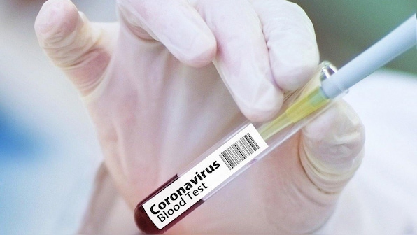 Recovered COVID-19 patients should donate plasma soon, antibodies may decline in 2-4 months, scientists say