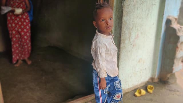 Three-year-old Umesh Bhambre mostly eats rice and dal whereas he should be getting high nutritious diet. Parth MN