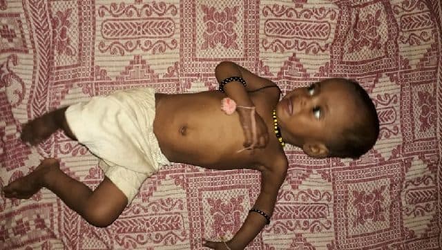 Even though Palghar is barely 100 kms from Mumbai, it is one of the most backward districts in Maharashtra, where malnutrition is a serious concern that stems from abject poverty. Parth MN
