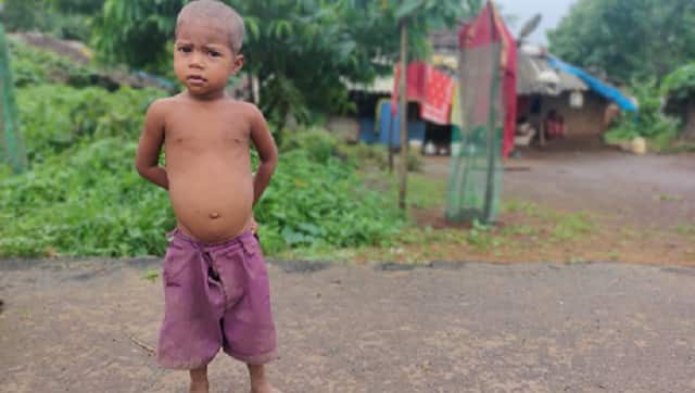 Shevanti’s 3-year-old grandson, Avinash falls under the severe acute malnutrition category. Parth MN