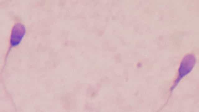 Rising use of electronic devices and worse sleep patterns behind increasing male infertility rate Rising use of electronic devices and worse sleep patterns behind increasing male infertility rate