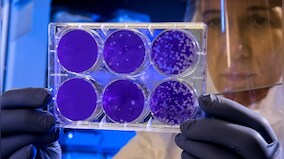Pleicomacrolides, a class of antibiotics, may help immune system kill HIV-infected cells, shows study